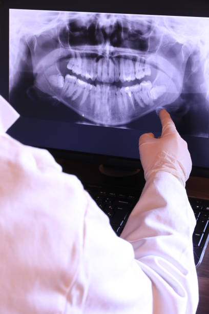 Best Emergency Dentist for Knocked-Out Tooth in Struthers, OH