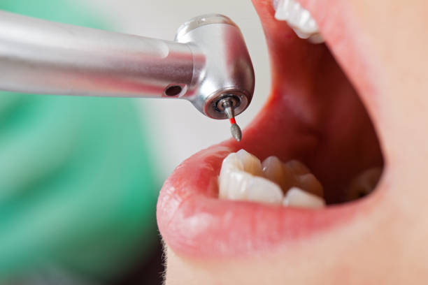 Best Broken or Cracked Tooth Emergency Dentist in Struthers, OH